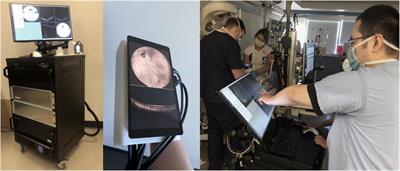 Widefield Optical Coherence Tomography in Pediatric Retina: A Case Series of Intraoperative Applications Using a Prototype Handheld Device